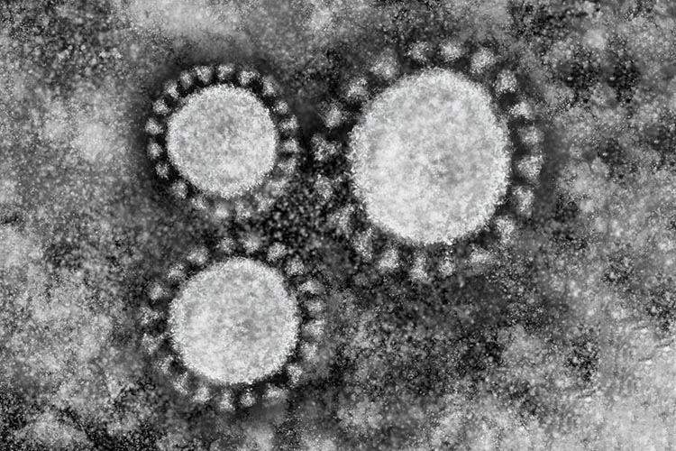 新型コロナウイルスイメージ画像